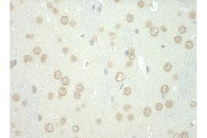 anti-WD Repeat and FYVE Domain Containing 3 (WDFY3) (AA 500-550) antibody