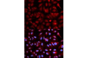 Immunofluorescence analysis of U2OS cells using PSMB5 antibody.