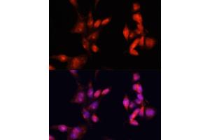 Immunofluorescence (IF) image for anti-Interleukin-1 Receptor-Associated Kinase 1 (IRAK1) (AA 424-633) antibody (ABIN6142514)