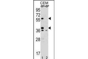 Western blot analysis of MNDA Antibody (N-term) Pab (ABIN655190 and ABIN2844806) pre-incubated without(lane 1) and with(lane 2) blocking peptide in CEM cell line lysate. (MNDA Antikörper  (N-Term))