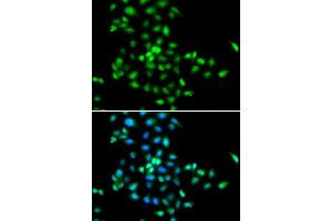 Immunofluorescence analysis of MCF-7 cells using SBDS antibody. (SBDS Antikörper  (AA 1-250))