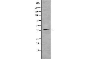 Western blot analysis of CCRL2 using A549 whole cell lysates (CCRL2 Antikörper  (Internal Region))