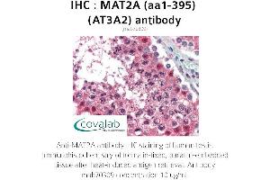 Image no. 2 for anti-Methionine Adenosyltransferase II, alpha (MAT2A) (AA 1-395) antibody (ABIN1724355) (MAT2A Antikörper  (AA 1-395))