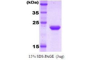 SDS-PAGE (SDS) image for Killer Cell Immunoglobulin-Like Receptor, Two Domains, Long Cytoplasmic Tail, 1 (KIR2DL1) protein (ABIN666833)
