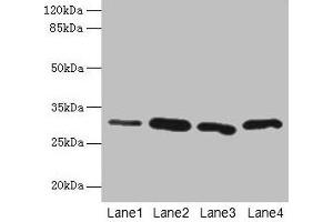 Western blot All lanes: CA3 antibody at 2 μg/mL Lane 1: Hela whole cell lysate Lane 2: HepG2 whole cell lysate Lane 3: K562 whole cell lysate Lane 4: NIH/3T3 whole cell lysate Secondary Goat polyclonal to rabbit IgG at 1/10000 dilution Predicted band size: 30 kDa Observed band size: 30 kDa (CA3 Antikörper  (AA 2-260))