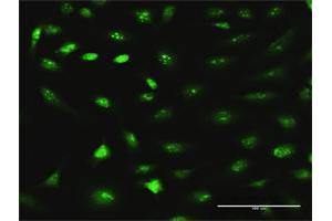 Immunofluorescence of purified MaxPab antibody to RRS1 on HeLa cell. (RRS1 Antikörper  (AA 1-365))