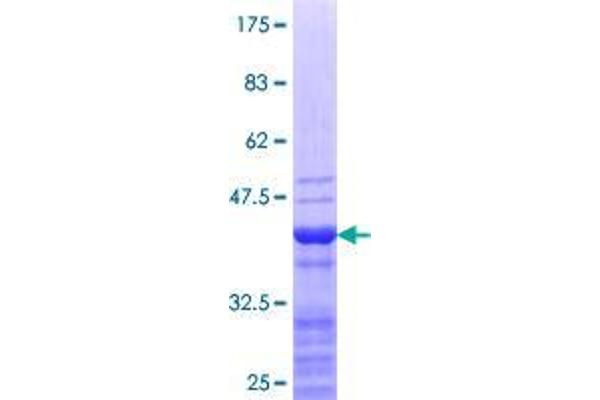 SP140 Protein (AA 504-612) (GST tag)