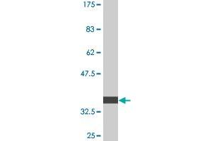 Western Blot detection against Immunogen (36. (PIK3R4 Antikörper  (AA 1259-1358))
