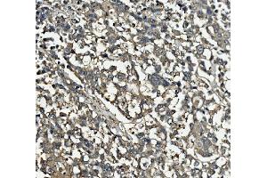 IHC analysis of Clathrin heavy chain/CLTC using anti-Clathrin heavy chain/CLTC antibody (ABIN7602703). (Clathrin Heavy Chain (CLTC) (AA 967-1668) Antikörper)