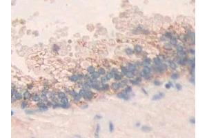Immunohistochemistry (IHC) image for anti-Matrix Metallopeptidase 24 (Membrane-inserted) (MMP24) (AA 429-642) antibody (ABIN7441787)