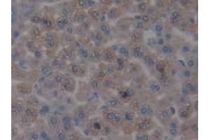 #VALUE! (CENPH Antikörper  (AA 28-241))