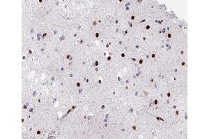 ABIN6266483 at 1/200 staining human brain tissue sections by IHC-P. (HNRNPD/AUF1 Antikörper  (Internal Region))