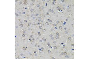 Immunohistochemistry of paraffin-embedded rat brain using AMPD1 antibody. (AMPD1 Antikörper)
