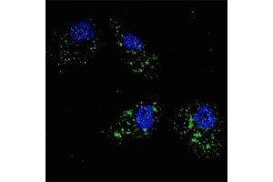 Fluorescent image of U251 cells stained with p62 antibody at 1:200. (SQSTM1 Antikörper  (AA 317-346))