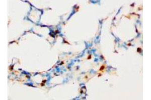 Immunohistochemical analysis of paraffin-embedded rat lung sections, stain SOCS1 in cytoplasm DAB chromogenic reaction.
