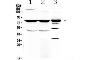 Western blot analysis of NSF using anti-NSF antibody . (NSF Antikörper  (AA 620-744))