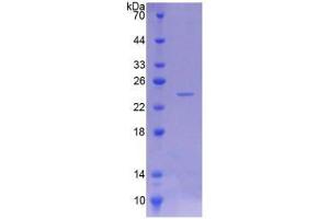 SDS-PAGE (SDS) image for Patatin-Like phospholipase Domain Containing 6 (PNPLA6) (AA 965-1137) protein (His tag) (ABIN4990705)