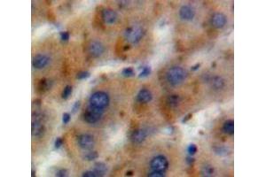 Used in DAB staining on fromalin fixed paraffin-embedded Liver tissue (GLN1 Antikörper  (AA 1-373))