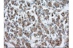 Immunohistochemistry (IHC) image for anti-Mitochondrial Translational Release Factor 1-Like (MTRF1L) antibody (ABIN1498695) (MTRF1L Antikörper)