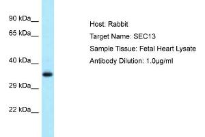 Host: Rabbit Target Name: SEC13 Sample Type: Fetal Heart lysates Antibody Dilution: 1. (SEC13 Antikörper  (C-Term))