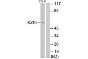 Western Blotting (WB) image for anti-IKAROS Family Zinc Finger 3 (Aiolos) (IKZF3) (AA 361-410) antibody (ABIN2889804)