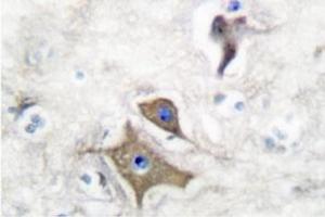 Image no. 2 for anti-Enolase 2 (Gamma, Neuronal) (ENO2) antibody (ABIN271752) (ENO2/NSE Antikörper)