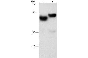 Western Blot analysis of Human fetal brain and liver tissue using AMZ1 Polyclonal Antibody at dilution of 1:1000
