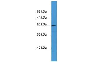 Western Blotting (WB) image for anti-CD22 Molecule (CD22) (N-Term) antibody (ABIN2788241)