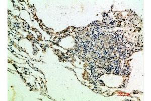 Immunohistochemical analysis of paraffin-embedded human-lung, antibody was diluted at 1:200 (THBS4 Antikörper  (AA 551-600))