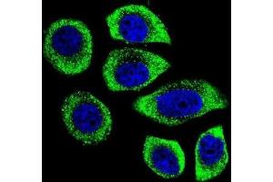 Immunofluorescence (IF) image for anti-Phosphatidylinositol-4-Phosphate 5-Kinase-Like 1 (PIP5KL1) antibody (ABIN2996126) (PIP5KL1 Antikörper)