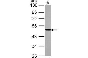 WB Image Sample (30 ug of whole cell lysate) A: A549 10% SDS PAGE antibody diluted at 1:1000 (KYNU Antikörper)