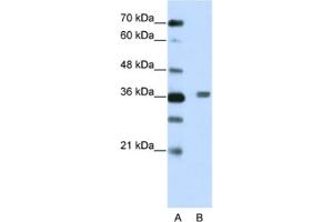 Western Blotting (WB) image for anti-BTB (POZ) Domain Containing 6 (BTBD6) antibody (ABIN2461967) (BTBD6 Antikörper)