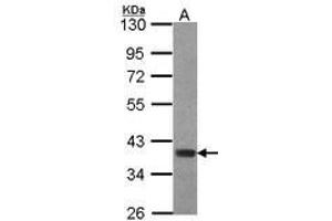 Image no. 1 for anti-Forkhead Box B1 (FOXB1) (AA 313-325) antibody (ABIN467476)