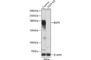 Western blot analysis of extracts from normal (control) and EGFR knockout (KO) HeLa cells using EGFR Polyclonal Antibody at dilution of 1:3000. (EGFR Antikörper)
