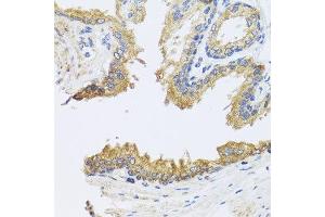 Immunohistochemistry of paraffin-embedded human prostate using ARL6 antibody at dilution of 1:100 (x40 lens). (ARL6 Antikörper)