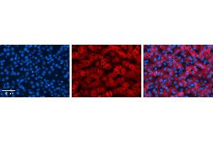 Immunohistochemistry (IHC) image for anti-Keratin 8 (KRT8) (N-Term) antibody (ABIN2777112)