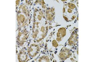 Immunohistochemistry of paraffin-embedded human stomach using CCNA2 antibody (ABIN1871532) at dilution of 1:100 (40x lens). (Cyclin A Antikörper)