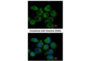 ICC/IF Image Immunofluorescence analysis of paraformaldehyde-fixed A431, using G protein alpha Inhibitor 2, antibody at 1:500 dilution. (GNAI2 Antikörper  (Center))