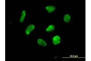 Immunofluorescence of purified MaxPab antibody to ZNF302 on HeLa cell. (ZNF302 Antikörper  (AA 1-399))