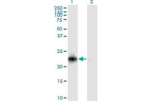 Western Blot analysis of RRAS2 expression in transfected 293T cell line by RRAS2 monoclonal antibody (M01A), clone 2D3-4B8. (RRAS2 Antikörper  (AA 1-204))