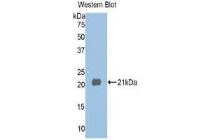 Western Blotting (WB) image for anti-Histone Deacetylase 6 (HDAC6) (AA 1038-1204) antibody (ABIN1859131) (HDAC6 Antikörper  (AA 1038-1204))
