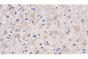 Detection of MCSF in Mouse Cerebellum Tissue using Polyclonal Antibody to Colony Stimulating Factor 1, Macrophage (MCSF) (M-CSF/CSF1 Antikörper  (AA 261-427))
