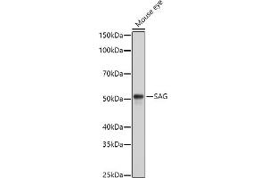 SAG Antikörper  (AA 1-405)