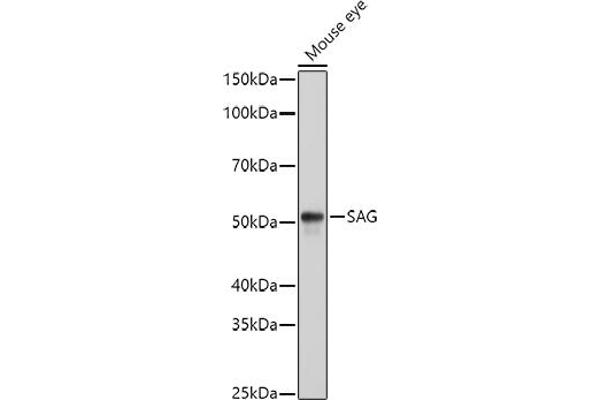 SAG Antikörper  (AA 1-405)