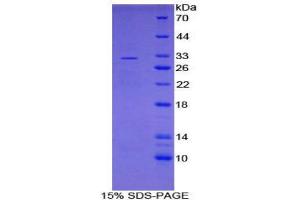 SDS-PAGE (SDS) image for CD274 (PD-L1) (AA 48-290) protein (His tag) (ABIN1879157) (PD-L1 Protein (AA 48-290) (His tag))