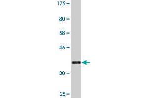 Western Blotting (WB) image for anti-DNA Meiotic Recombinase 1 (DMC1) (AA 237-339) antibody (ABIN524564)