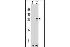 Western blot analysis of FGF9 (arrow) using rabbit polyclonal FGF9 Antibody (N-term) (ABIN654171 and ABIN2844030). (FGF9 Antikörper  (N-Term))