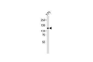 Western blot analysis of lysate from Y79 cell line, using ANKRD24 Antibody (Center) (ABIN6244224 and ABIN6577526). (ANKRD24 Antikörper  (AA 296-328))