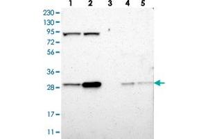 Western blot analysis of Lane 1: RT-4, Lane 2: U-251 MG, Lane 3: Human Plasma, Lane 4: Liver, Lane 5: Tonsil with CLIC4 polyclonal antibody  at 1:250-1:500 dilution. (CLIC4 Antikörper)