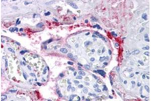 Human Placenta: Formalin-Fixed, Paraffin-Embedded (FFPE) (Integrin beta 3 Antikörper)